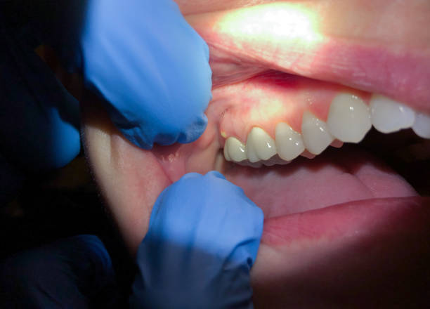 Best Pediatric Emergency Dentist in Farmington, MO